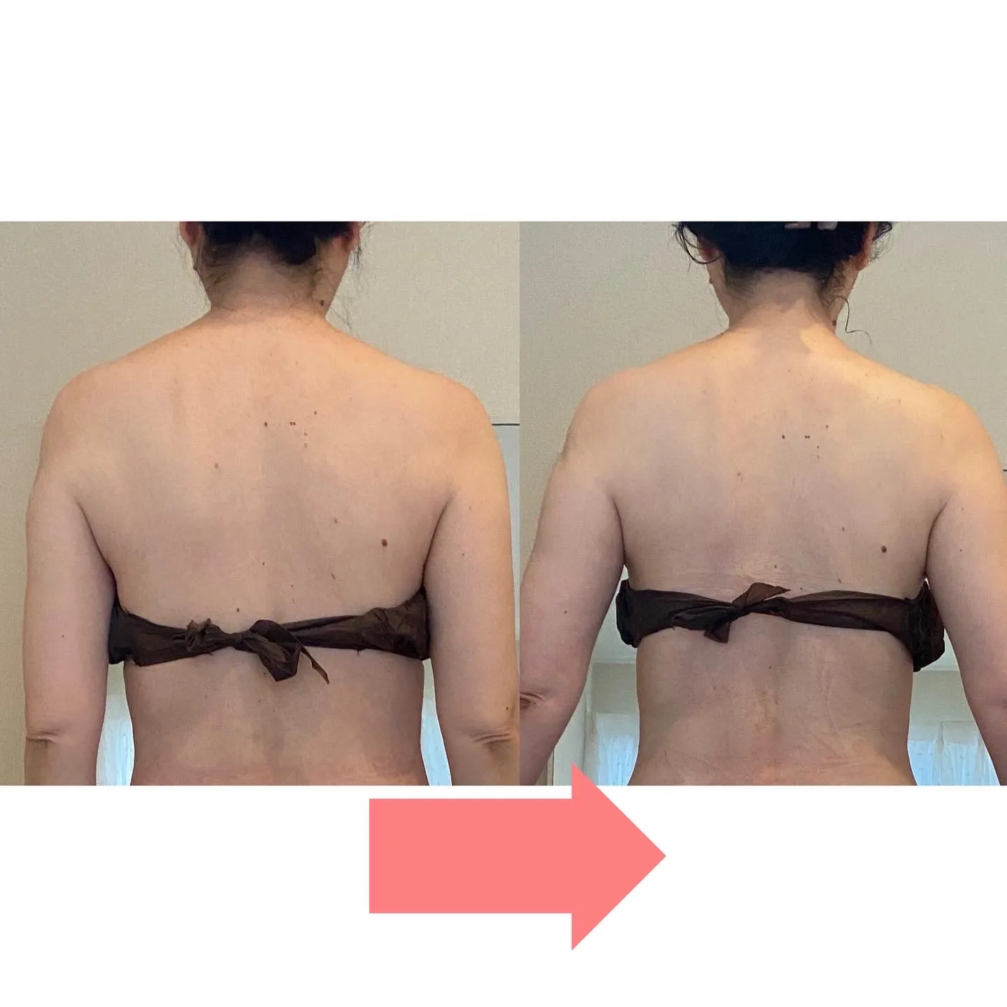 デトックスリンパ1回の変化①