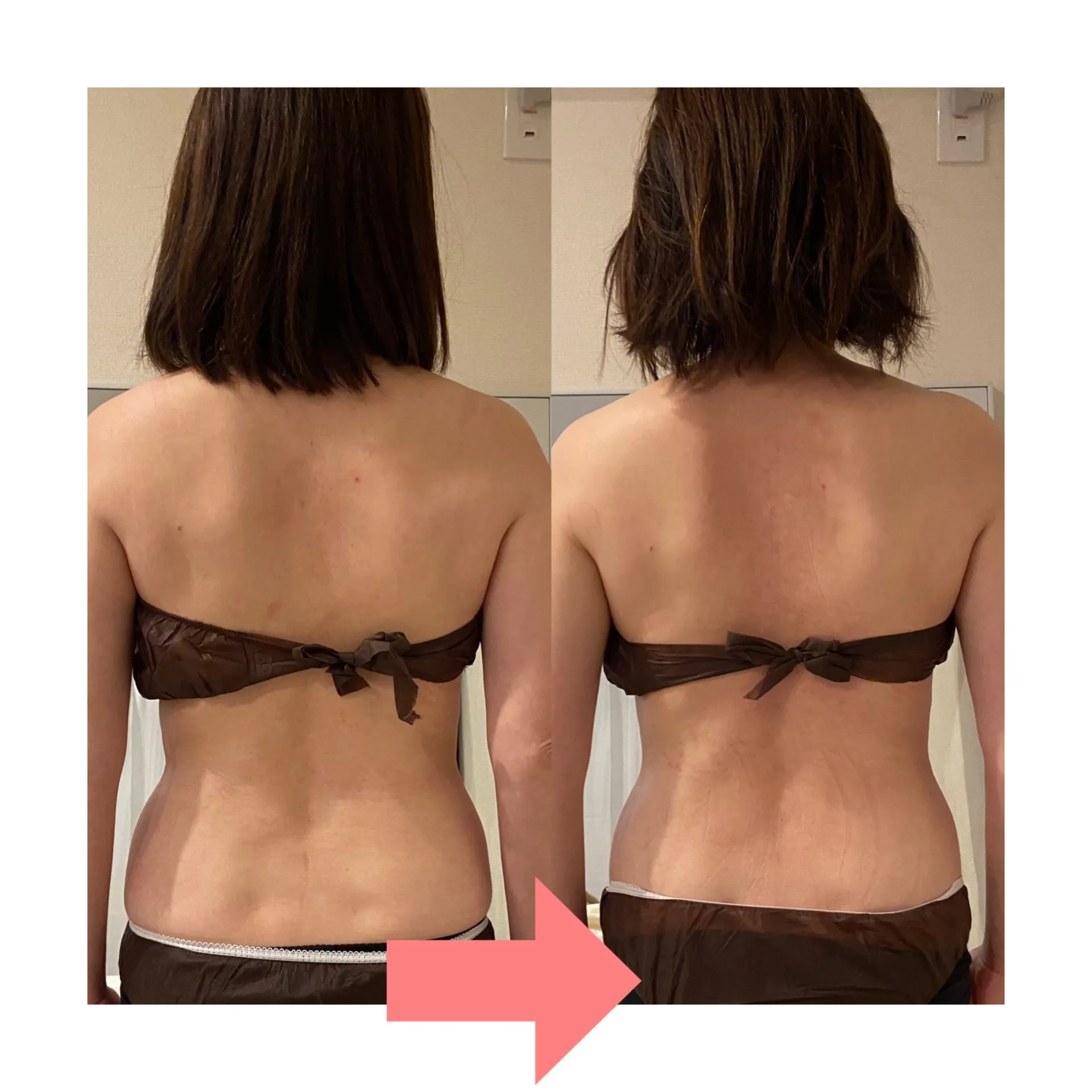 デトックスリンパ1回の変化②